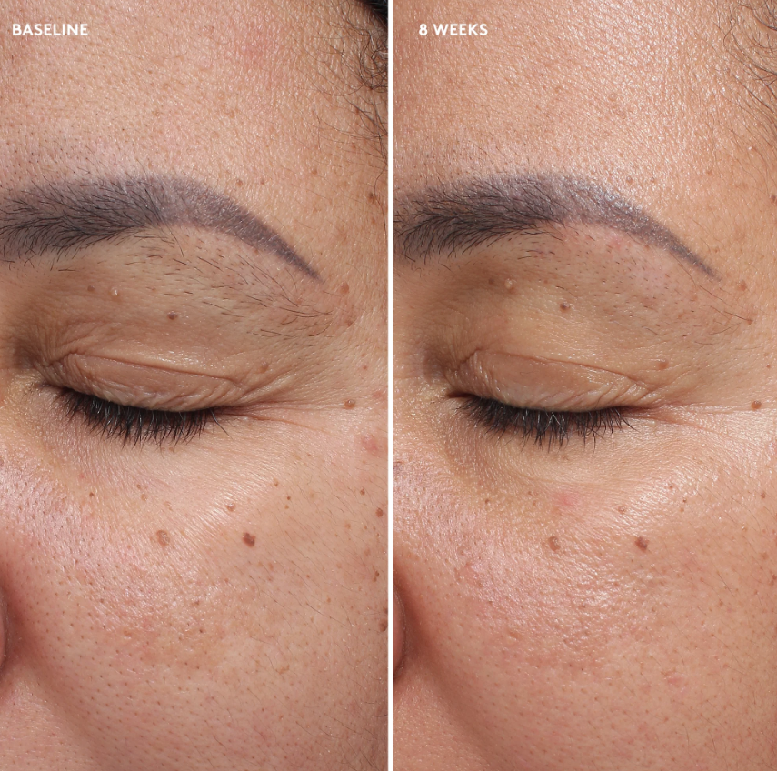 colorescience Total Eye Firm&Repair Cream before after