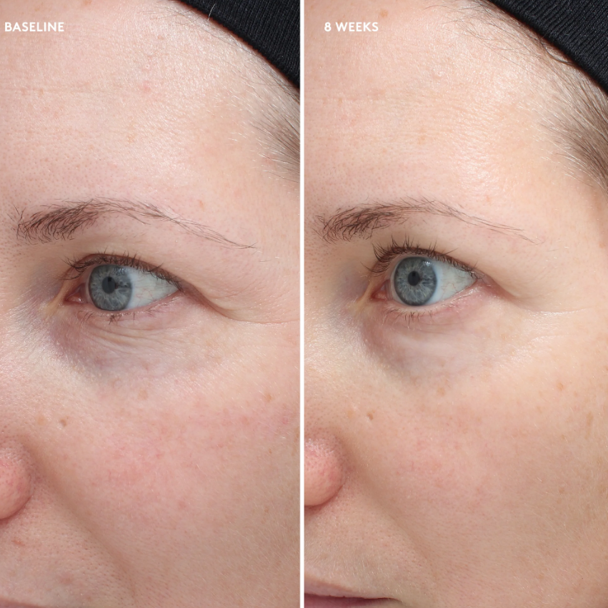 colorescience Total Eye Firm&Repair Cream elotte utana